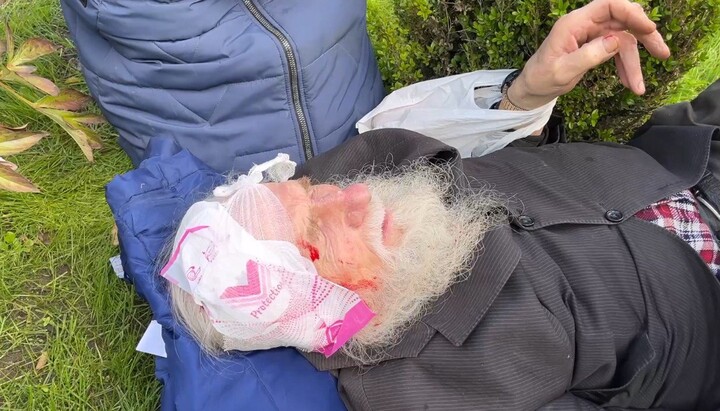 Monk Nektariy after the brutal attack by OCU raiders. Photo: Cherkasy Eparchy