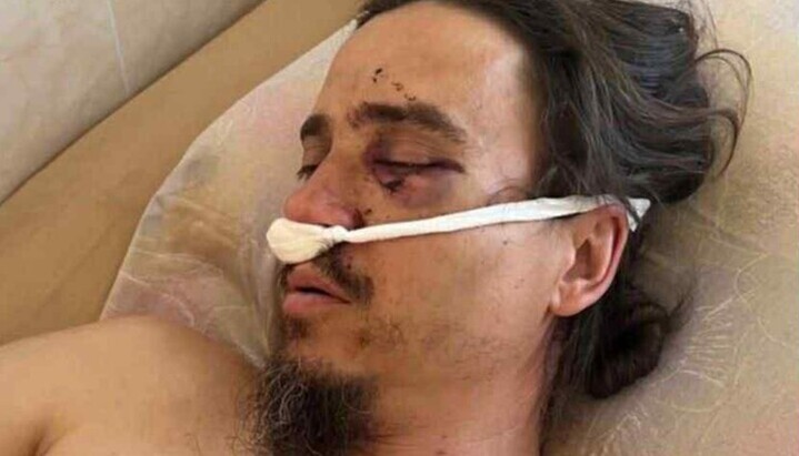 Свештеника УПЦ, оца Романа јуришници су пребили поред храма у Черновцима. Фото: Orthobuk