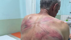 Епархија захтева независну истрагу: тешко повређен Србин из Дрена 